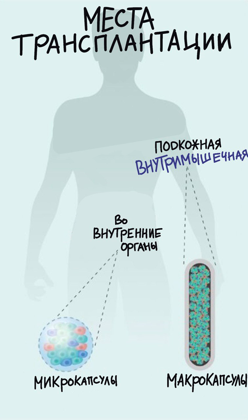 Потенциальные места для трансплантации островковых клеток