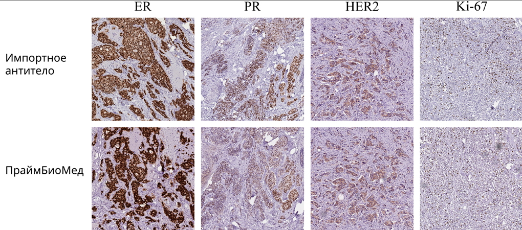 Сравнение антител от «ПраймБиоМеда» с американскими аналогами