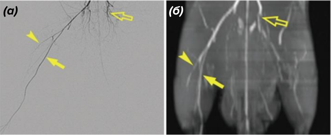 Ангиограмма (а) и TOF-MRA (б) у крыс Sprague-Dawley на 14-й день ишемии задней конечности