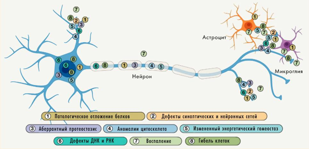 Локализация патологических изменений при нейродегенерации внутри клеток