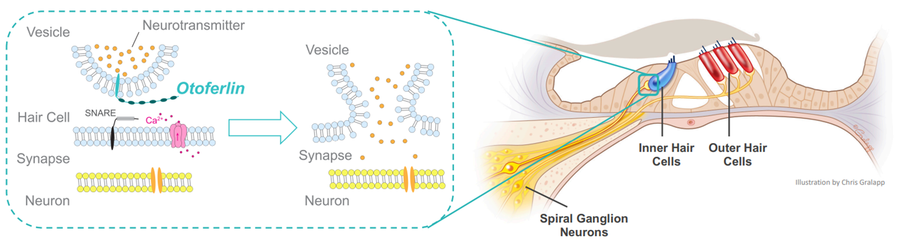 Схематичное изображение отоферлина и последствий его дисфункции