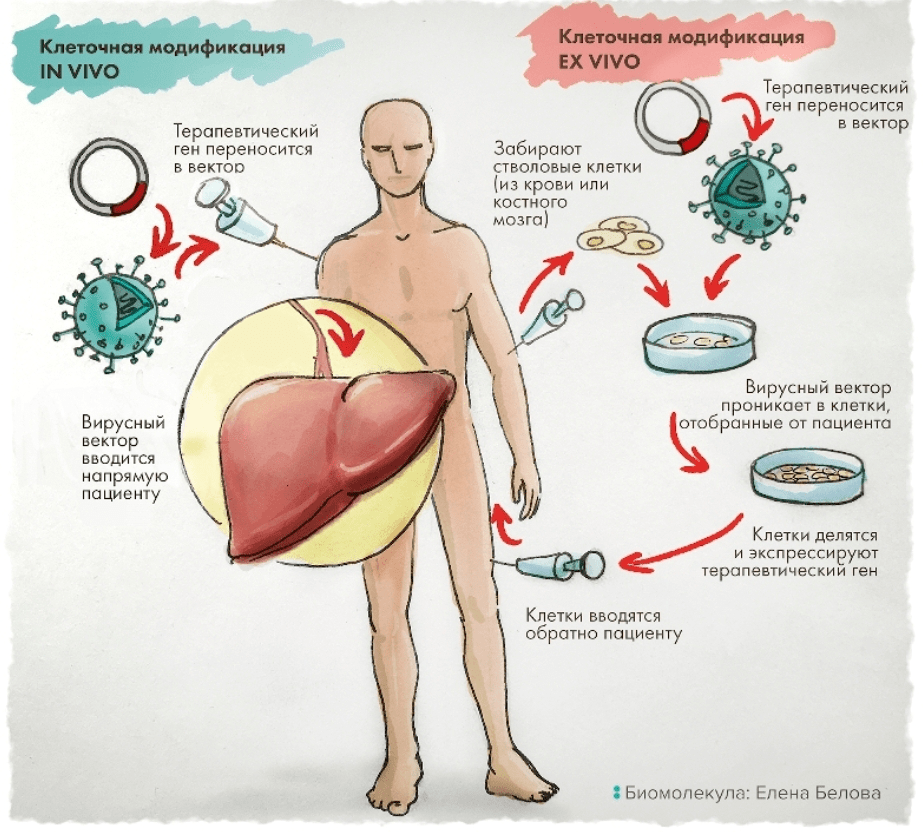 Рисунок 18. Два подхода к генной терапии