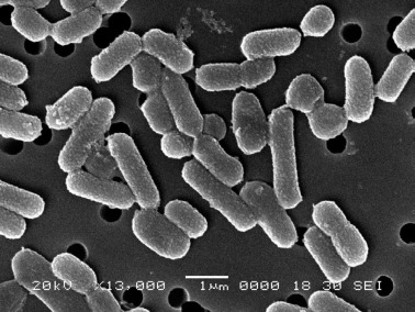 Lactobacillus plantarum