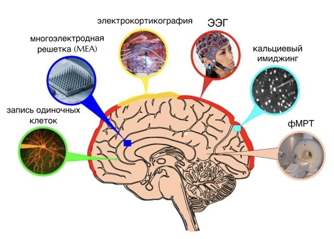 Распространенные методы регистрации активности мозга