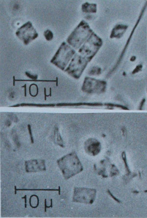 Haloquadratum walsbyi