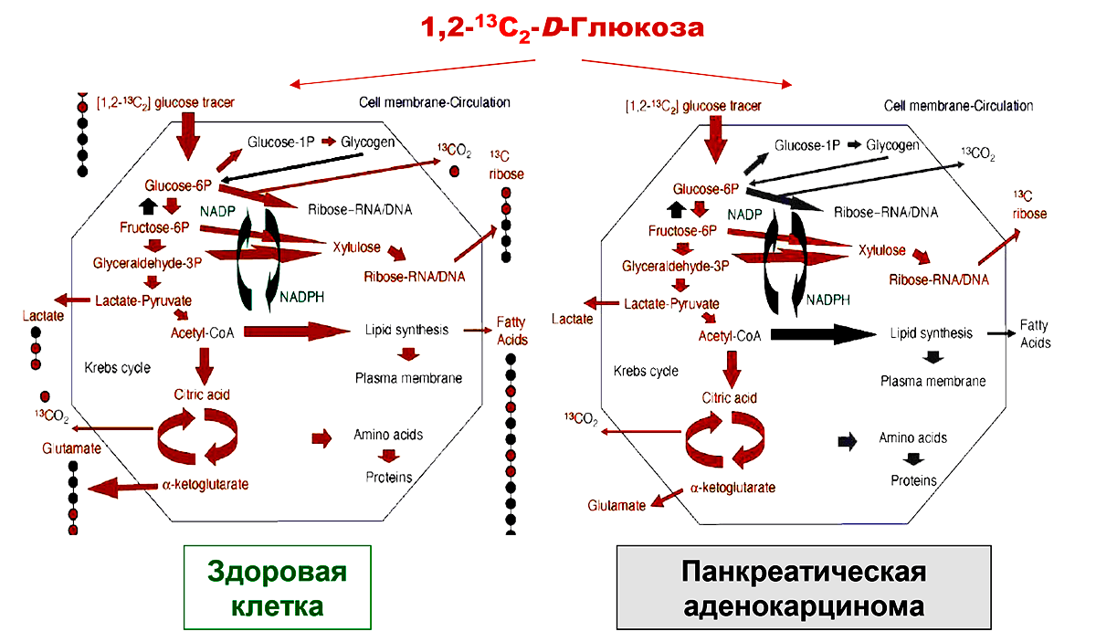 Метаболизм D-глюкозы в здоровой и опухолевой клетках