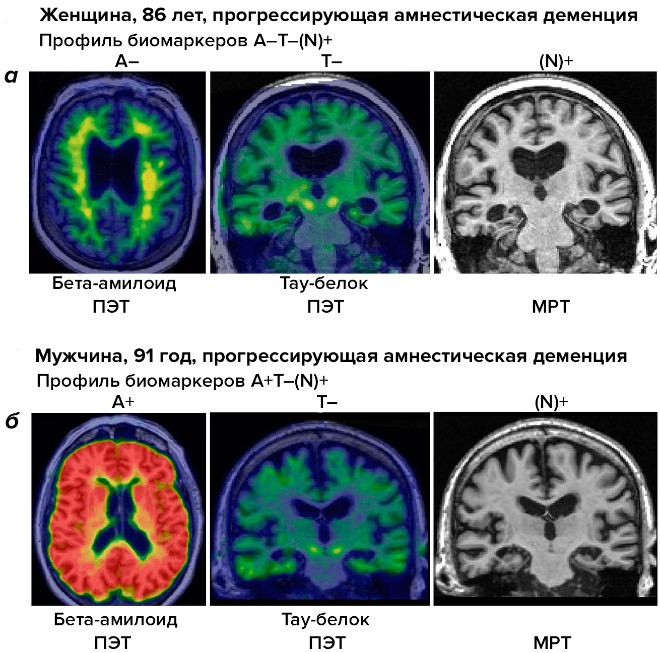 Система ATN