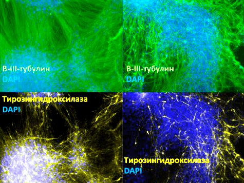 Зрелые нейроны