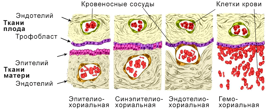 Классификация плаценты по степени инвазии