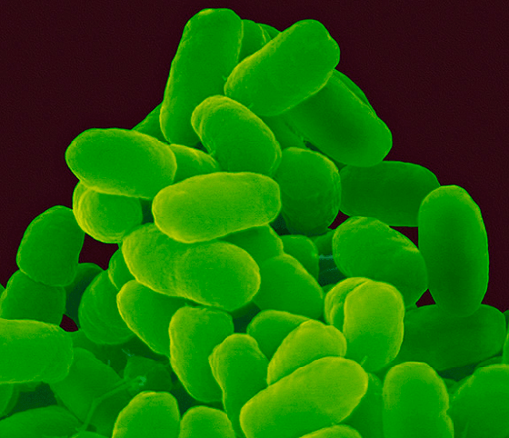 Bordetella pertussis