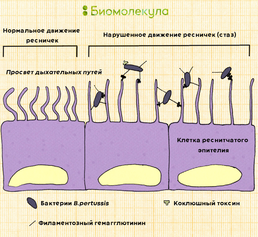 Колонизация клеток респираторного эпителия коклюшными бактериями