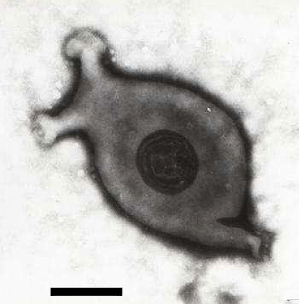 Mycoplasma gallisepticum